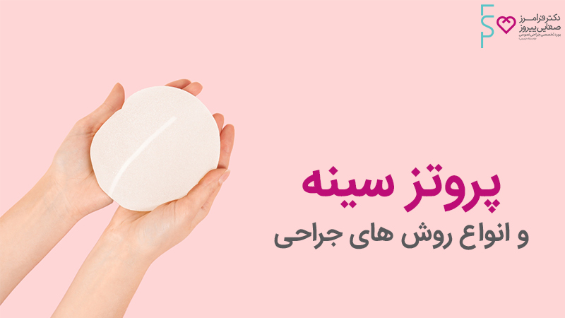 پروتز سینه و انواع روش های جراحی